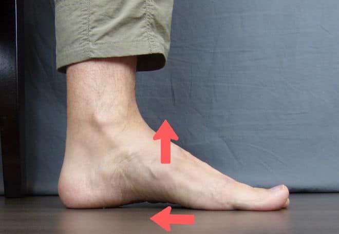 درمان صافی کف پا - کفش شهپر